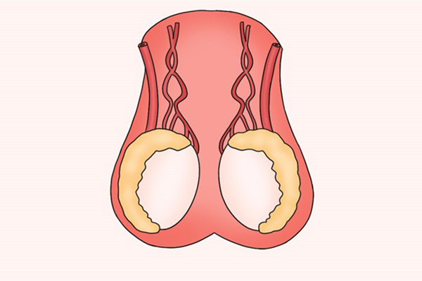 吃非那雄胺片睾丸疼痛怎么办